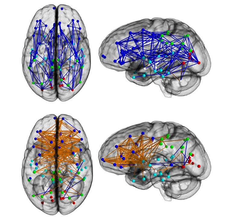 erkek ve kadın beyni arasındaki fark-gerçek bilim